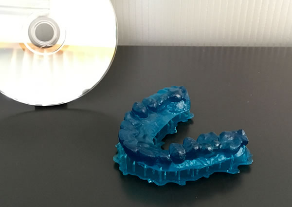 3Dプリンタ造形事例：歯科モデル